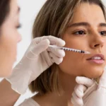 doctor injecting woman's lips