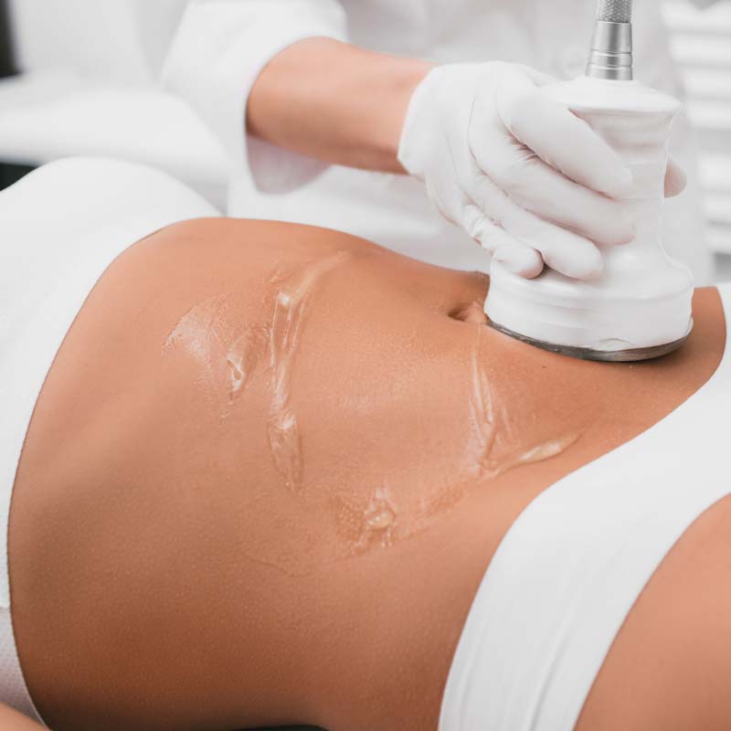 laser in the abdominal area