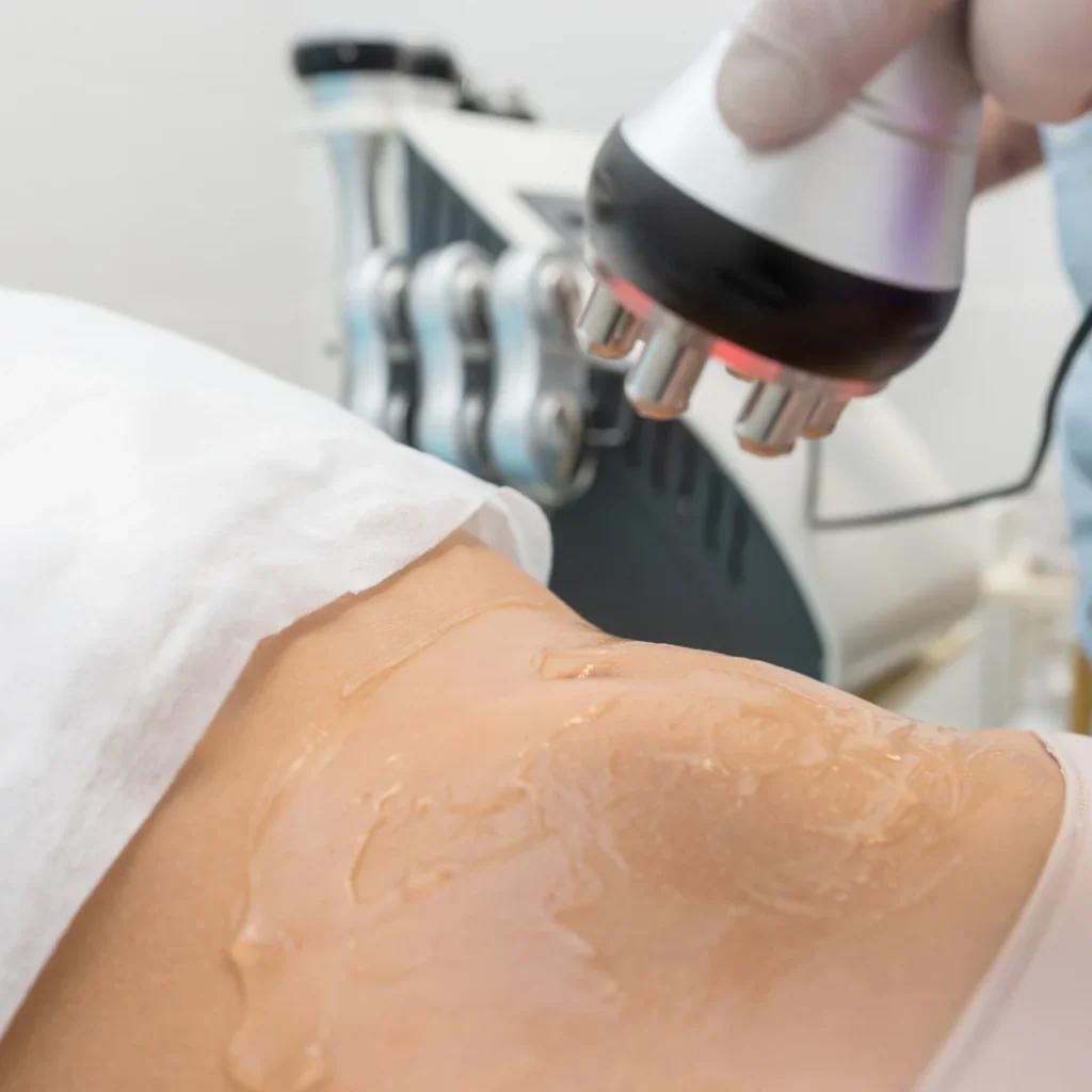 laser therapy on the back